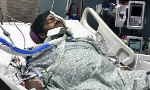 Hyderabad Student in Critical Condition After Severe Car Crash in Alabama